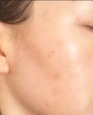 After-Skin-Lighten-Serum