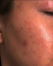 Before-Skin-Lighten-Serum